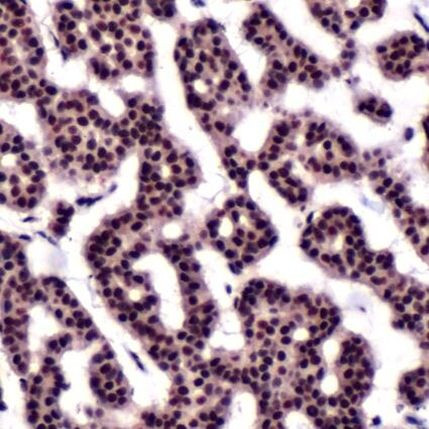 Thymidylate Synthase Antibody in Immunohistochemistry (IHC)