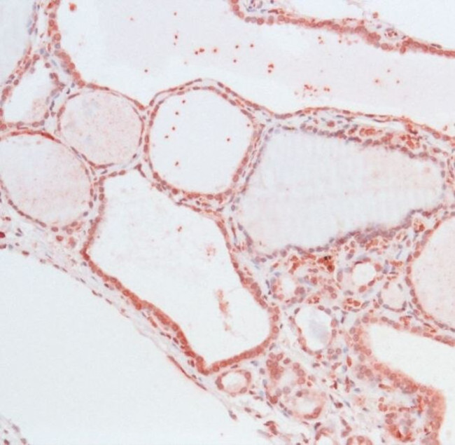THRA Antibody in Immunohistochemistry (IHC)