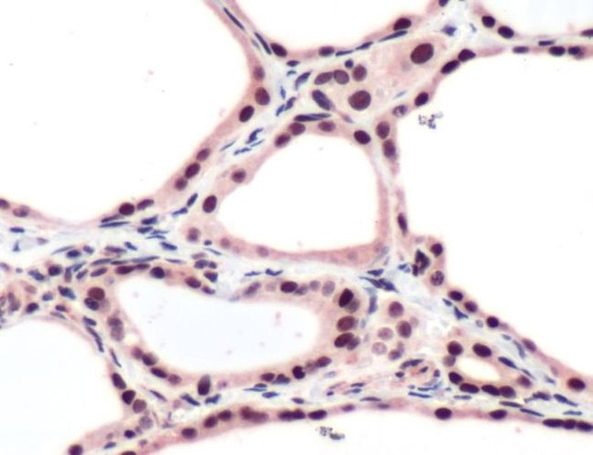 THRB Antibody in Immunohistochemistry (IHC)