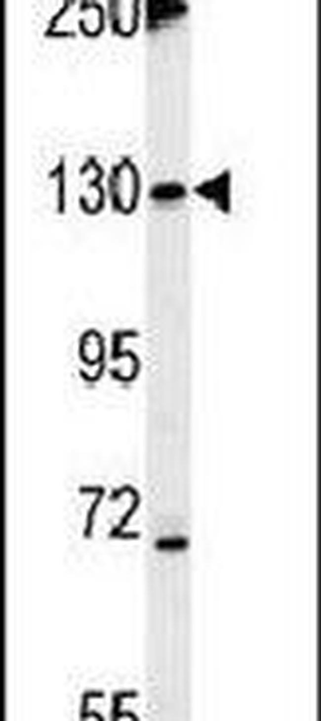 Tankyrase 2 Antibody in Western Blot (WB)