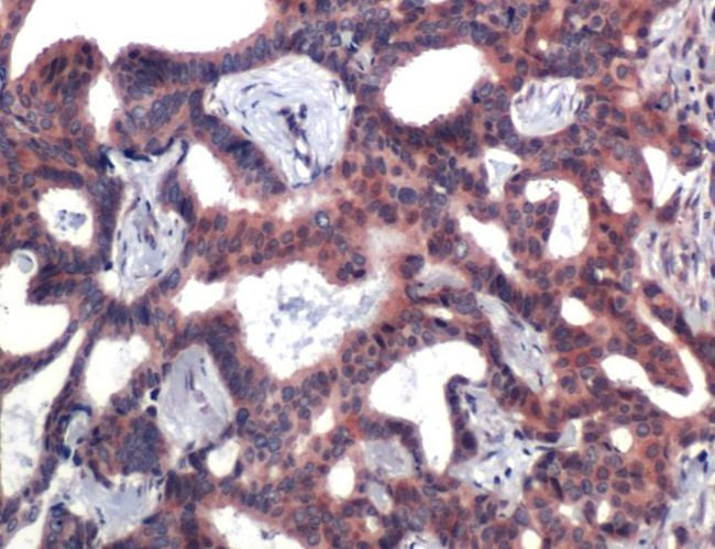 TOP1 Antibody in Immunohistochemistry (IHC)
