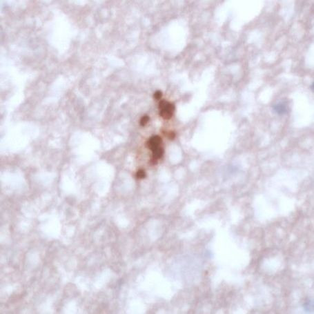 Toxoplasma Gondii Antibody in Immunohistochemistry (IHC)