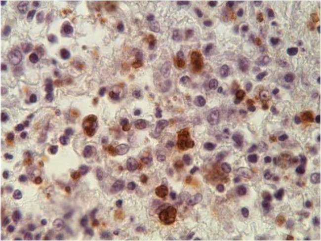 Toxoplasma gondii Antibody in Immunohistochemistry (IHC)