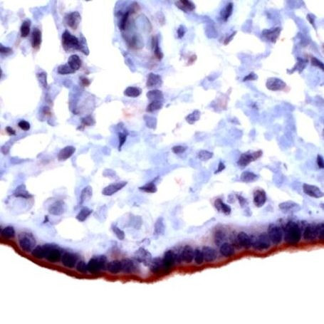 TGFBR3 Antibody in Immunohistochemistry (IHC)