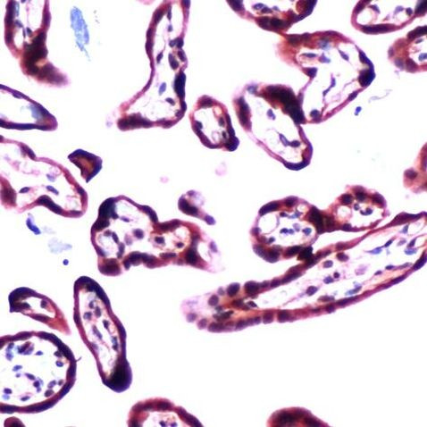 TGF beta-2 Antibody in Immunohistochemistry (IHC)