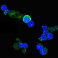 TrkA Antibody in Immunocytochemistry (ICC/IF)