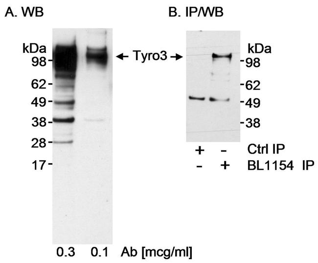 Tyro3 Antibody in Western Blot (WB)