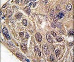YARS Antibody in Immunohistochemistry (IHC)