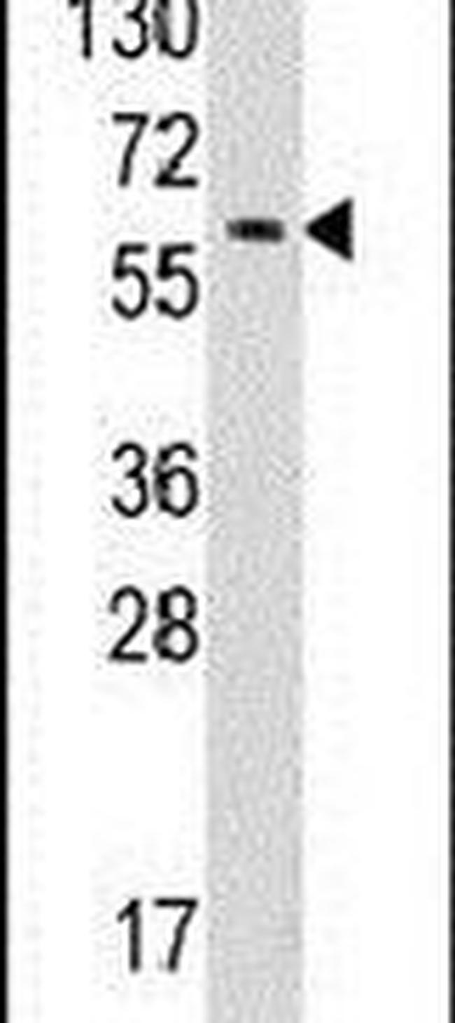 YARS Antibody in Western Blot (WB)