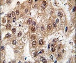 U2AF1 Antibody in Immunohistochemistry (IHC)