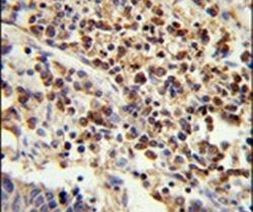 U2AF1 Antibody in Immunohistochemistry (IHC)