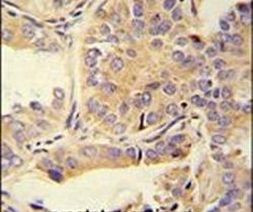 UBA52 Antibody in Immunohistochemistry (IHC)