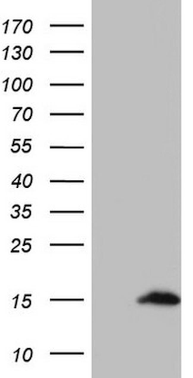 UBA52 Antibody in Western Blot (WB)