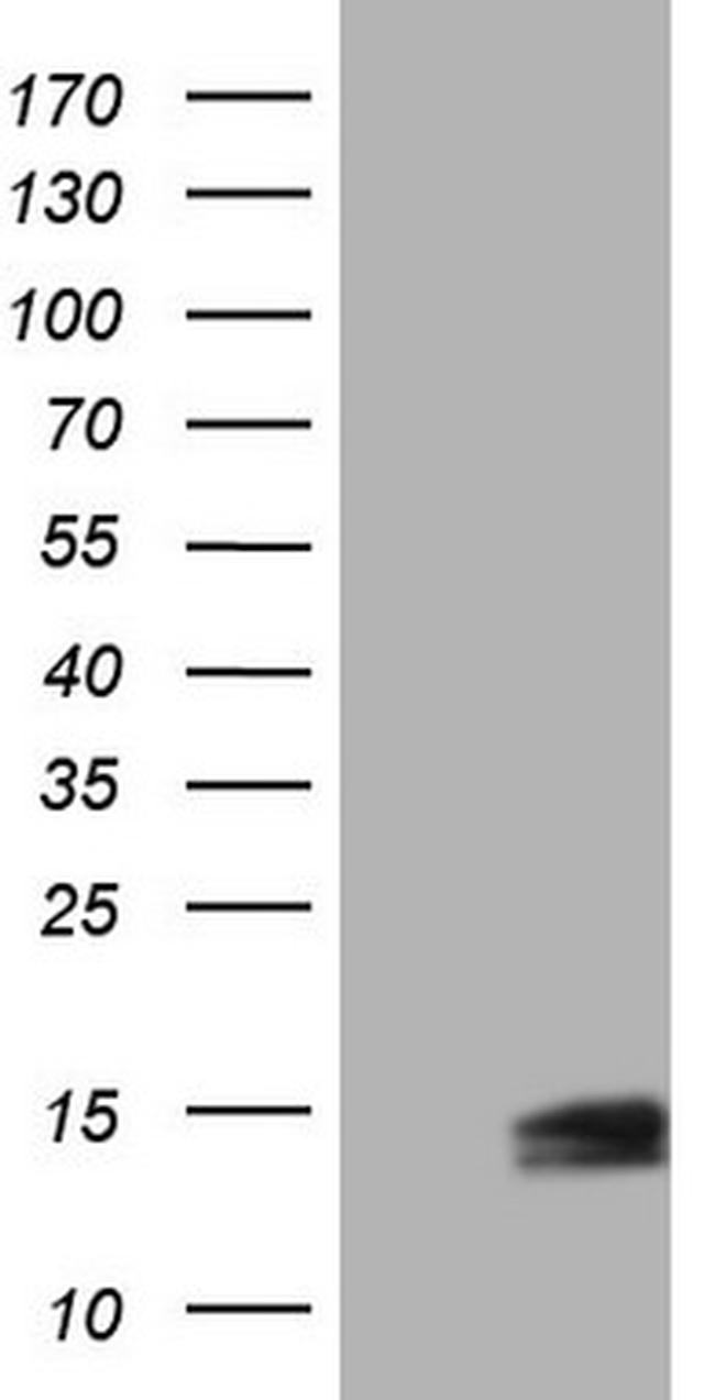 UBA52 Antibody in Western Blot (WB)