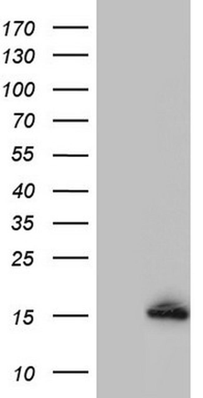 UBA52 Antibody in Western Blot (WB)