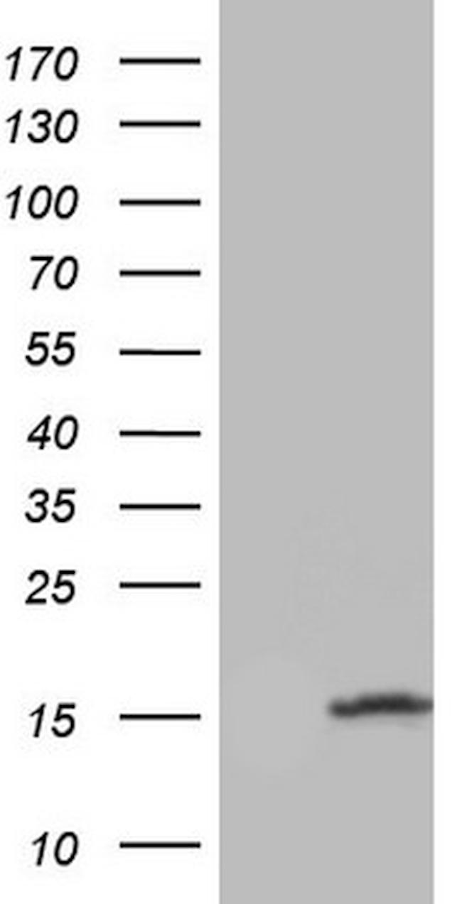 UBA52 Antibody in Western Blot (WB)