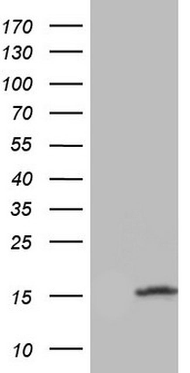 UBA52 Antibody in Western Blot (WB)
