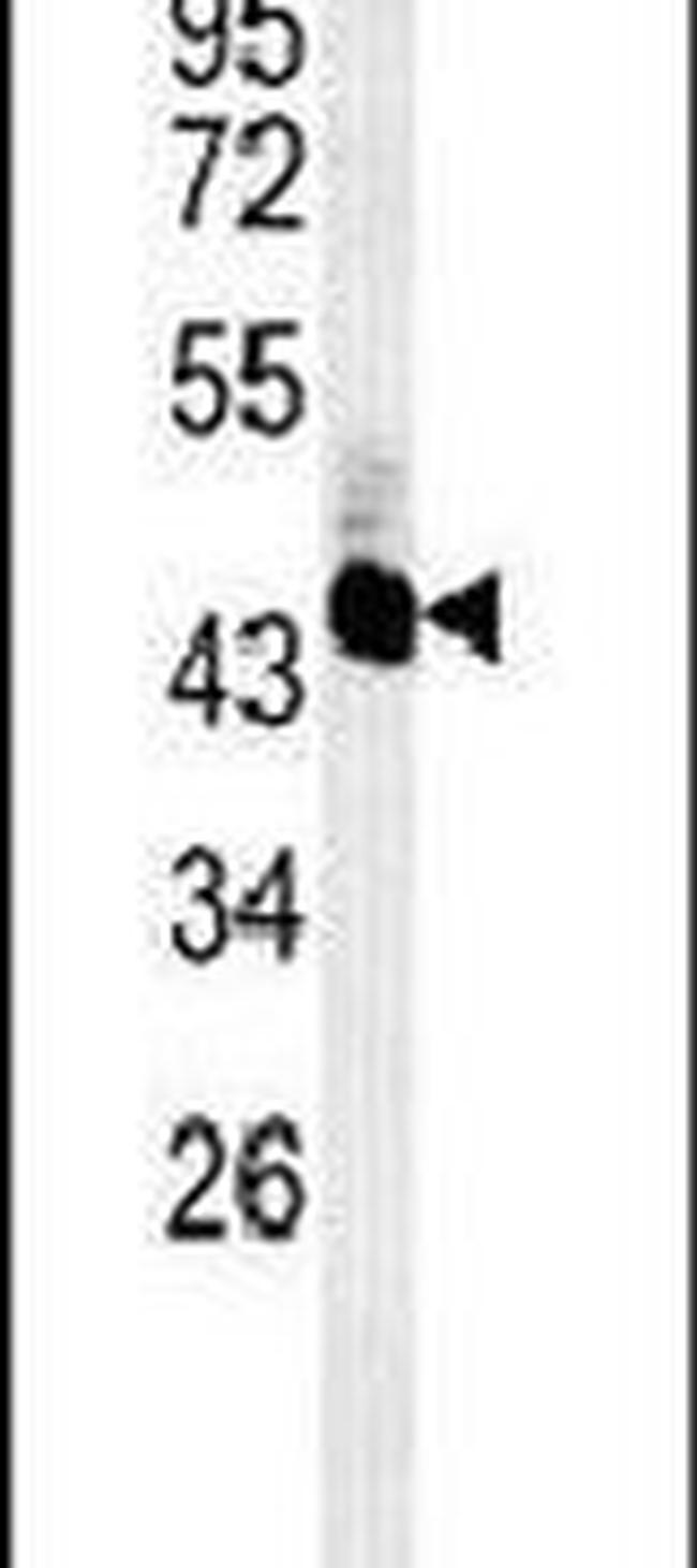 UBAC2 Antibody in Western Blot (WB)