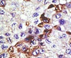 UBE2E3 Antibody in Immunohistochemistry (IHC)