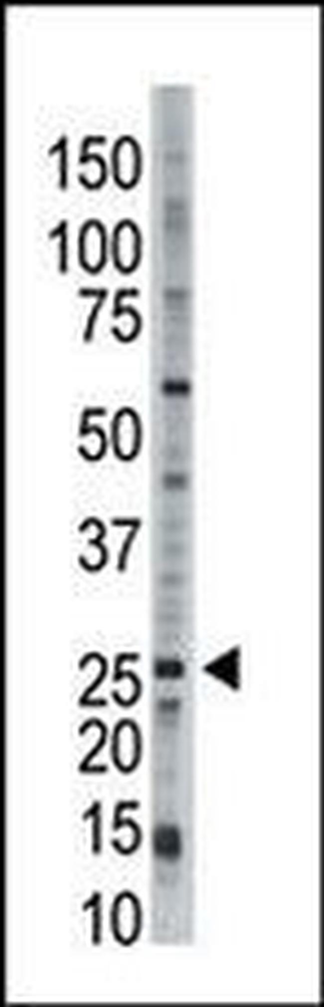 UBE2E3 Antibody in Western Blot (WB)