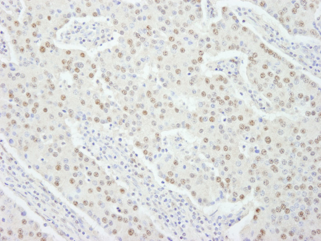 UBE1 Antibody in Immunohistochemistry (IHC)