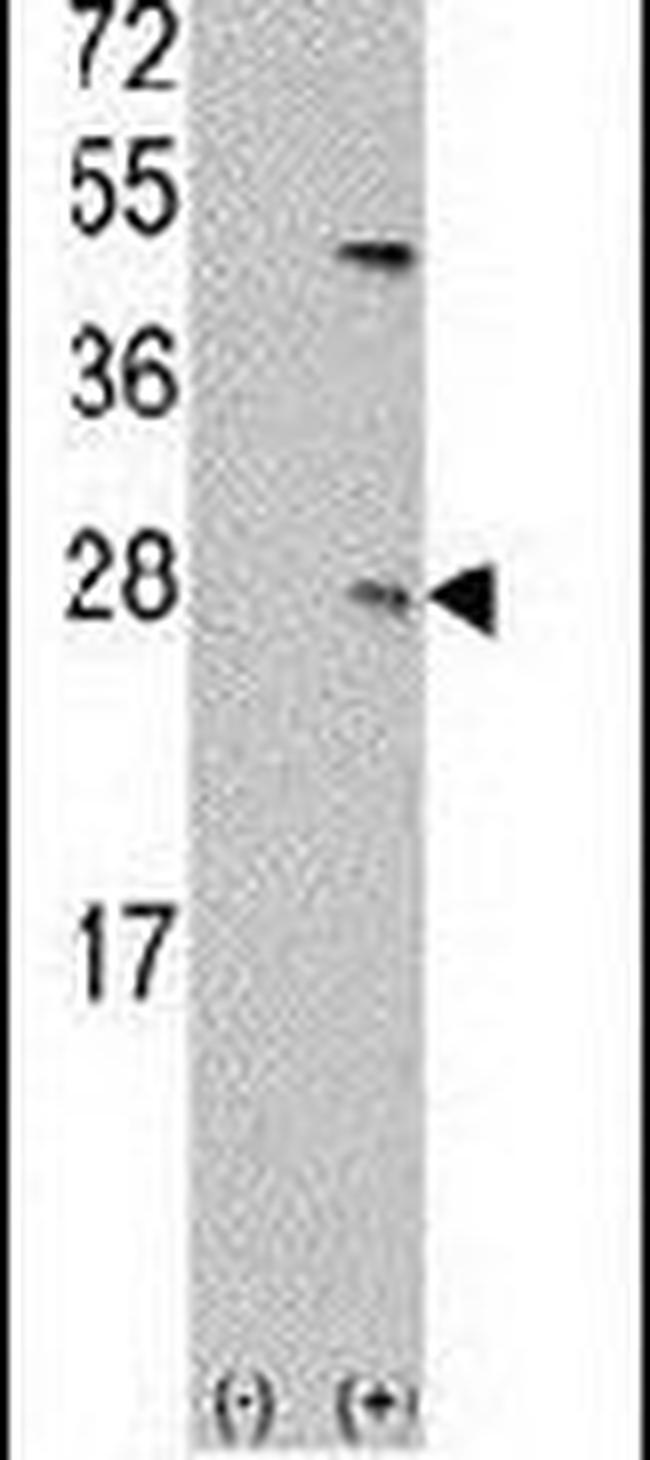UBE2C Antibody in Western Blot (WB)