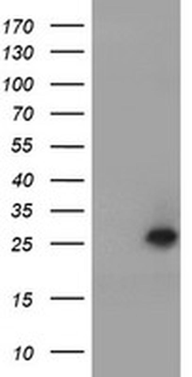 UBE2E3 Antibody in Western Blot (WB)