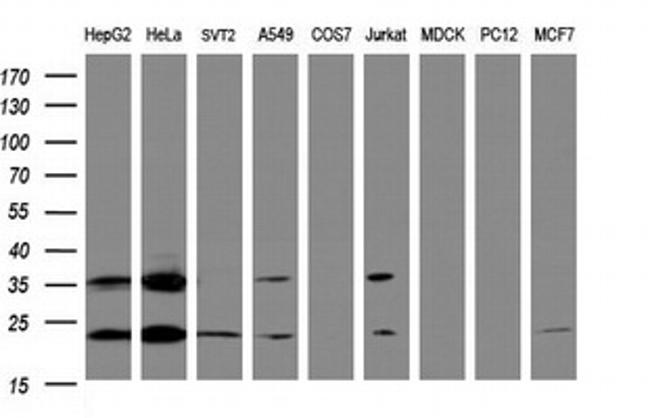 UBE2E3 Antibody in Western Blot (WB)