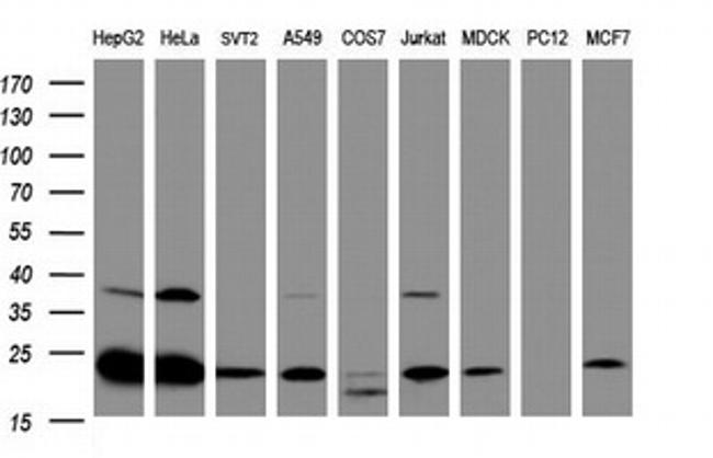 UBE2E3 Antibody in Western Blot (WB)