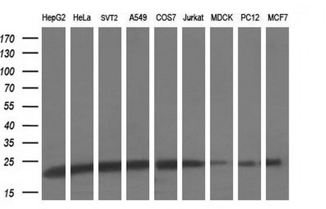 UBE2E3 Antibody in Western Blot (WB)