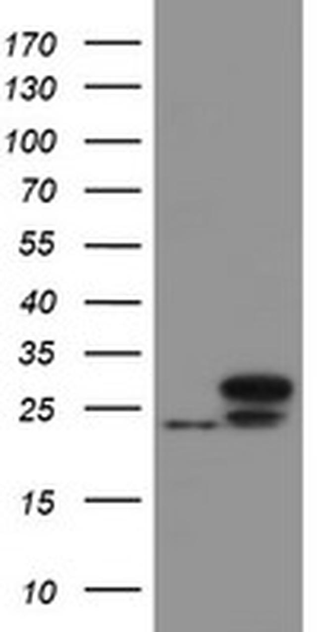UBE2E3 Antibody in Western Blot (WB)