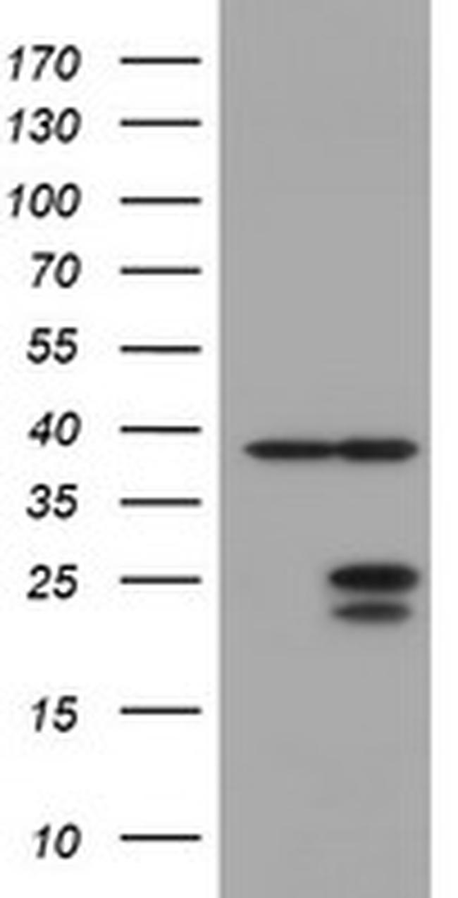 UBE2E3 Antibody in Western Blot (WB)