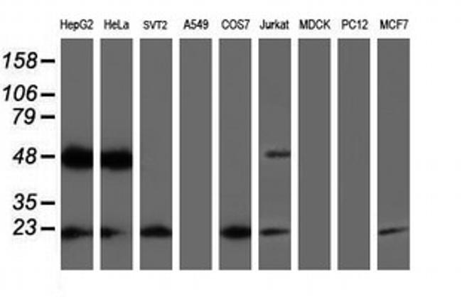 UBE2E3 Antibody in Western Blot (WB)
