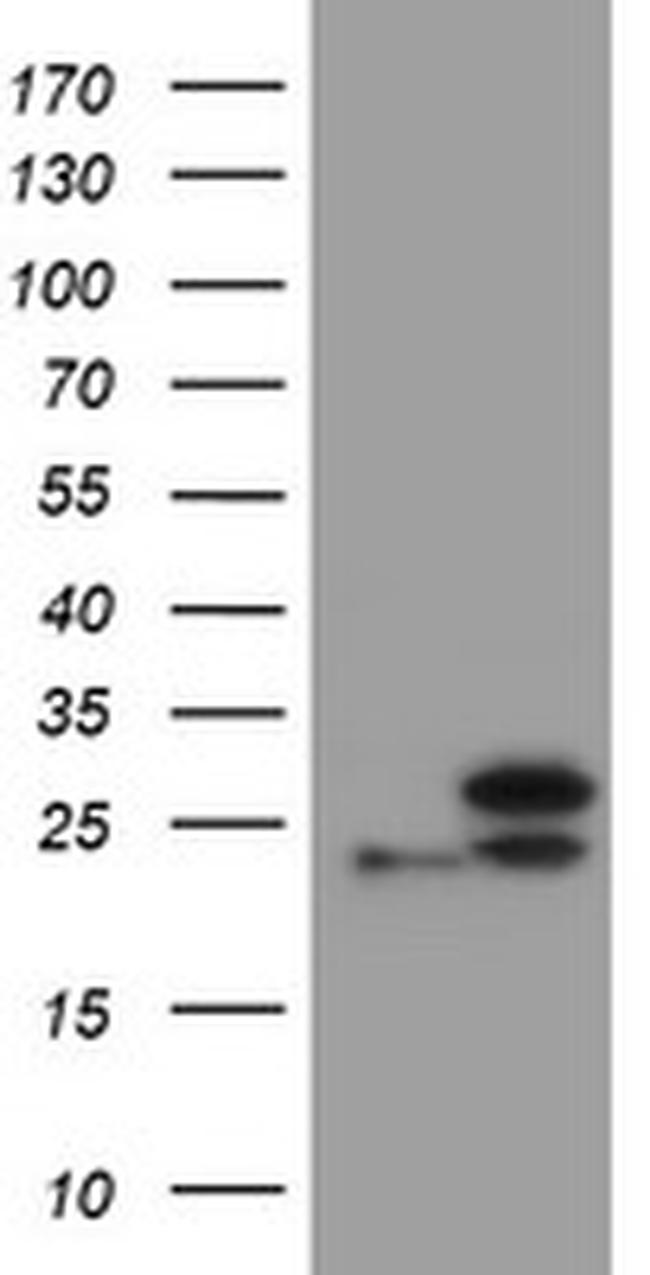 UBE2E3 Antibody in Western Blot (WB)