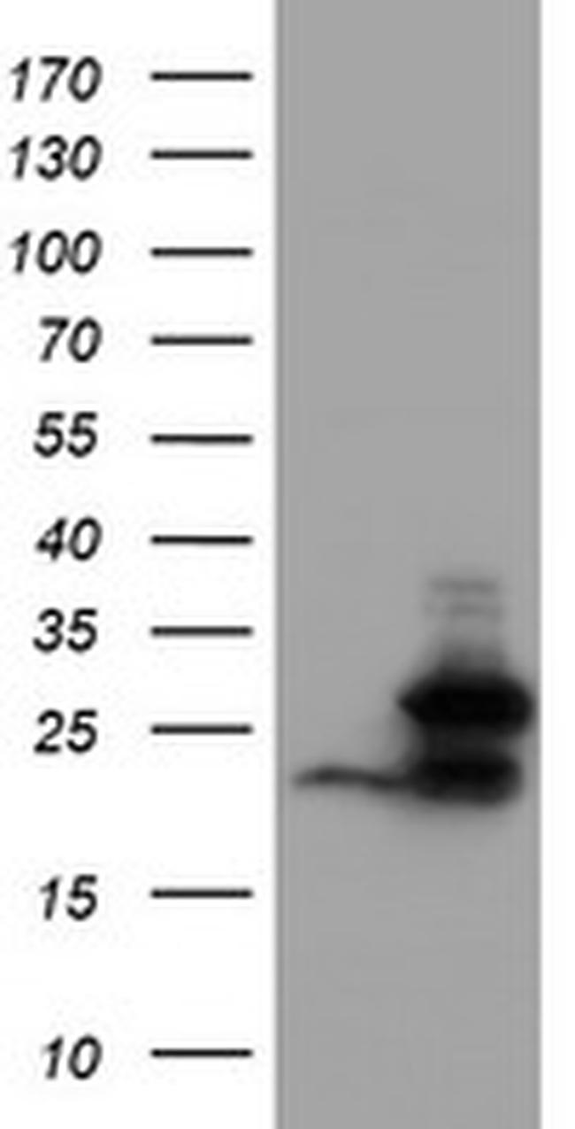 UBE2E3 Antibody in Western Blot (WB)