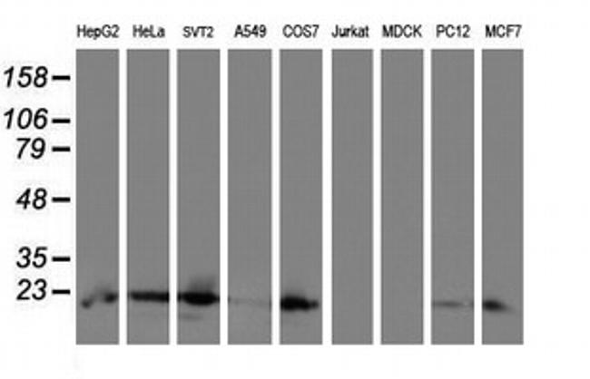 UBE2E3 Antibody in Western Blot (WB)