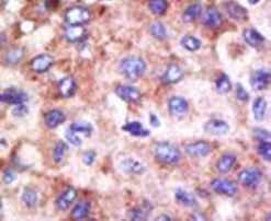 UBE2G1 Antibody in Immunohistochemistry (IHC)