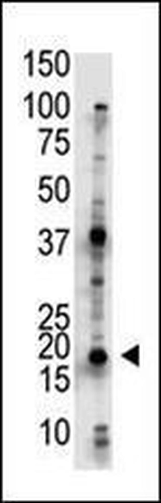 UBE2G2 Antibody in Western Blot (WB)