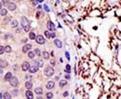 UBE2L3 Antibody in Immunohistochemistry (IHC)