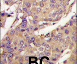 UBE2L6 Antibody in Immunohistochemistry (IHC)