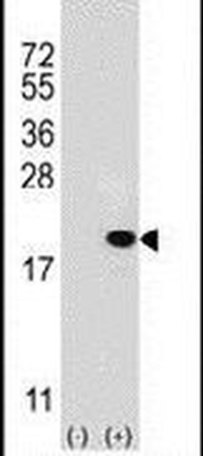 UBE2V1 Antibody in Western Blot (WB)