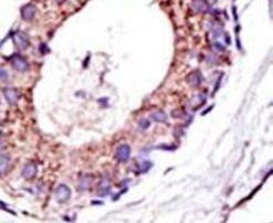 UBE4A Antibody in Immunohistochemistry (IHC)