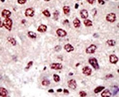 UBE4B Antibody in Immunohistochemistry (IHC)