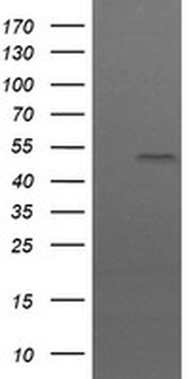 UBOX5 Antibody in Western Blot (WB)