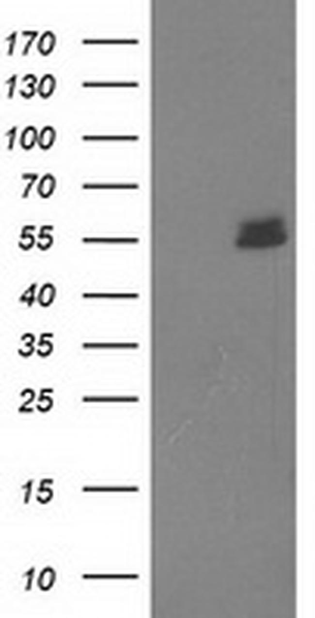 UBOX5 Antibody in Western Blot (WB)