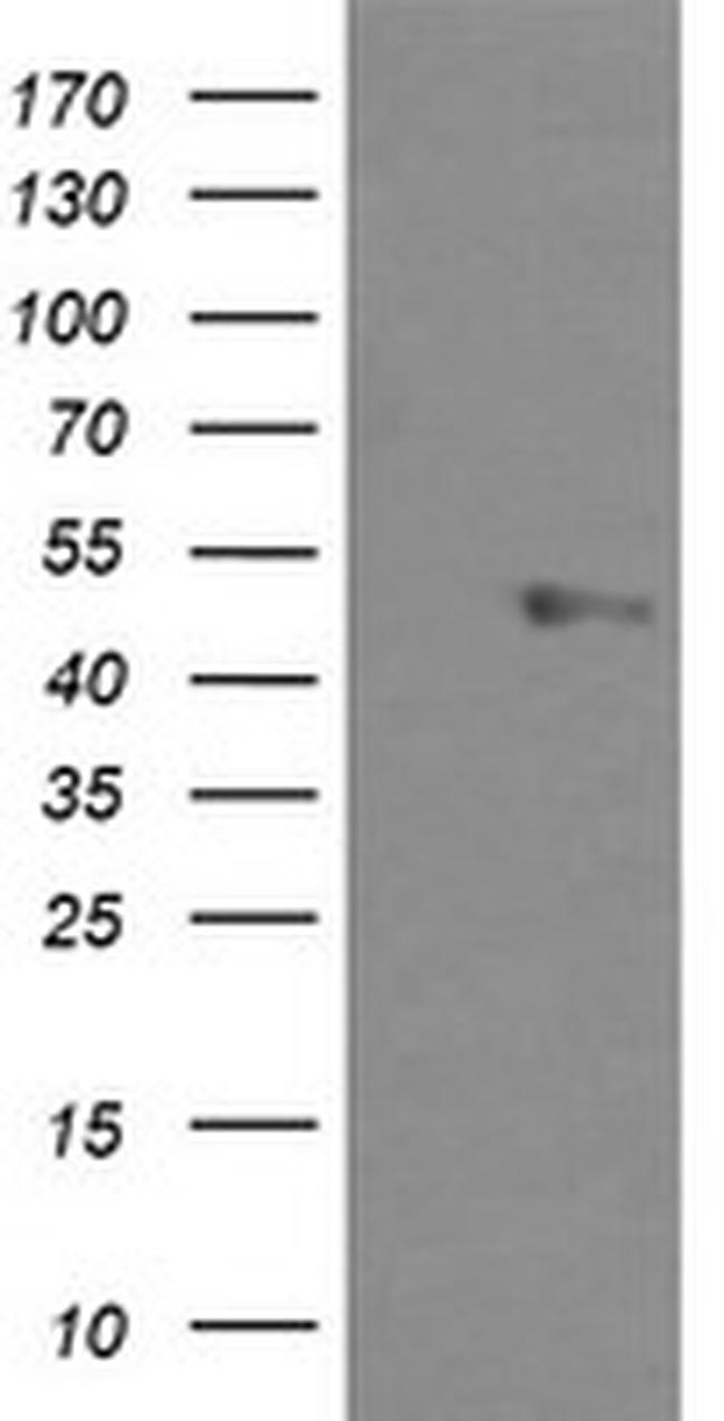 UBOX5 Antibody in Western Blot (WB)
