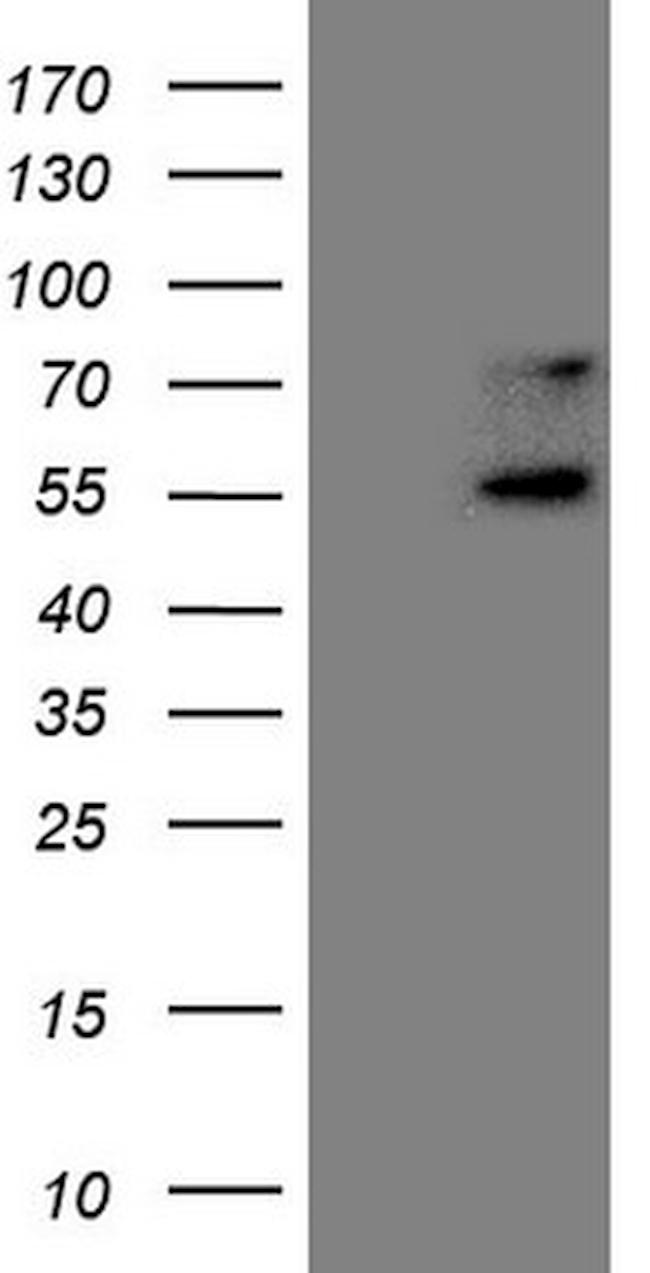 UBP1 Antibody in Western Blot (WB)