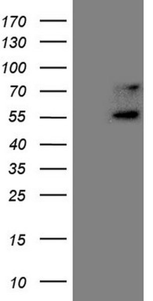 UBP1 Antibody in Western Blot (WB)