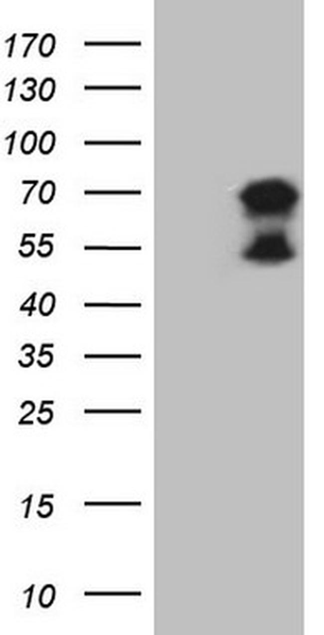 UBP1 Antibody in Western Blot (WB)