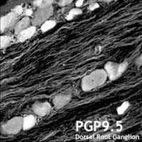 PGP9.5 Antibody in Immunohistochemistry (IHC)